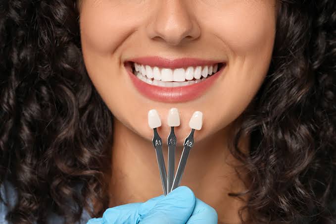 Why More Adults Are Choosing Veneers